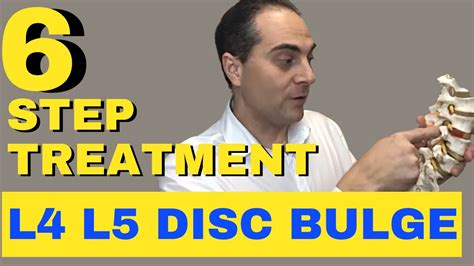 6 Step L4 L5 Disc Bulge Treatment L4 L5 Bulging Disc Treatment by Dr. Walter Salubro - YouTube