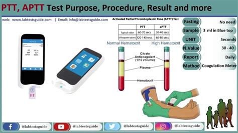 APTT (Activated Partial Thromboplastin Time) | Lab Tests Guide