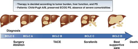 Evidence-Based Diagnosis, Staging, and Treatment of Patients With Hepatocellular Carcinoma ...