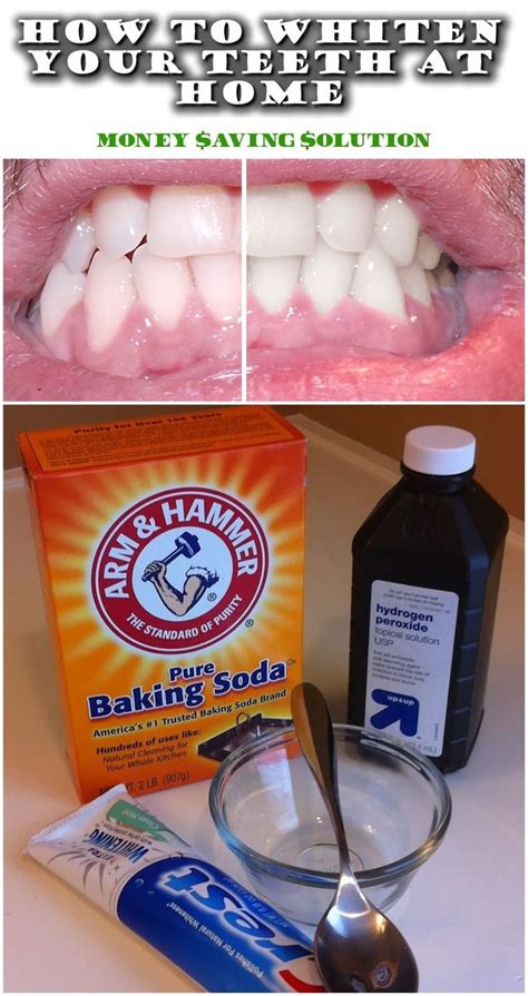 Pin on Homemade Whitening of Teeth