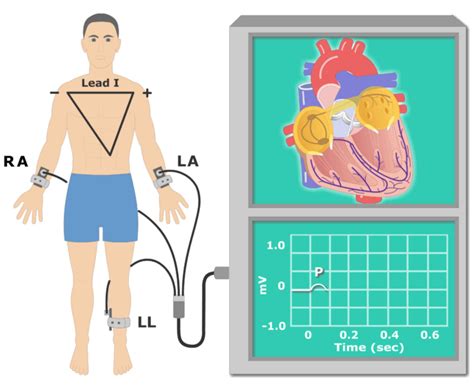 The Electrocardiogram (EKG or ECG) | GetBodySmart