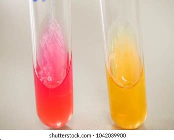 Positive Negative Results Mannitol Salt Agar Stock Photo 1042039900 | Shutterstock