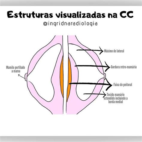 Radiologia Simplificada no Instagram: “Você sabe quais são as ...