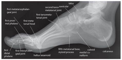 Normal Foot Xray Lateral