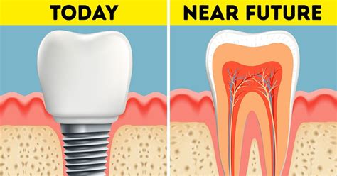 Scientists Found a Way to Regrow Teeth in 2 Months / Bright Side