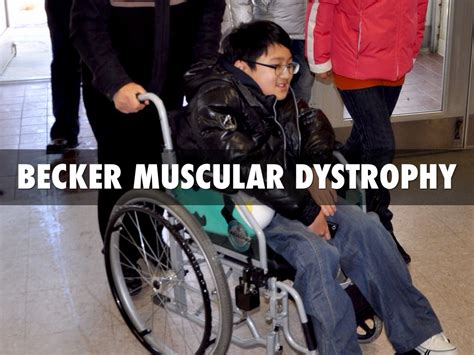 Becker Muscular Dystrophy by Javin Payne