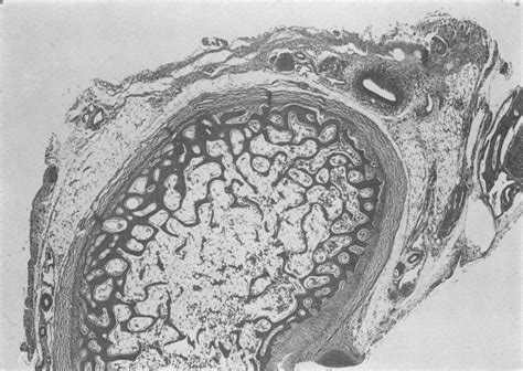 Histological section from the left hock joint 10 days after f.p ...