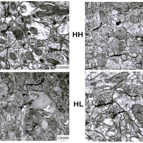 The picture shows the ultrastructure changes of pyramidal cells in the ...