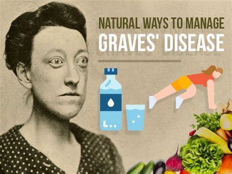 8 Natural Ways To Manage Graves' Disease: From Exercise To An Anti ...