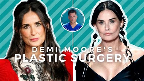 DEMI MOORE BEFORE AND AFTER: Beverly Hills Plastic Surgeon Explains ...