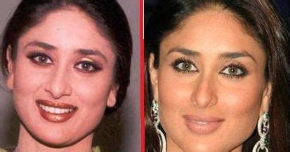 Kareena Kapoor after nose job – Celebrity plastic surgery online