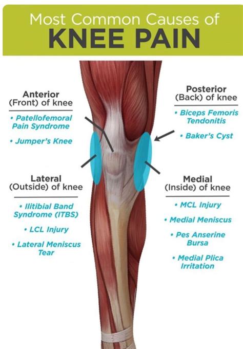 Mcl Injury, Knee Injury, Baker's Cyst, Bicep Tendonitis, Jumpers Knee ...