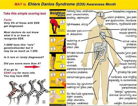 Pin by Colleen Archbold on Ehlers danlos | Ehlers danlos syndrome ...