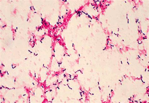 Special Stain Gram for Microbiology (with basic fuchsin) – Diapath