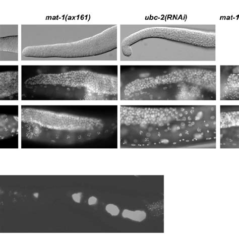 C. elegans gonad phenotypes associated with ubc-2 RNAi. (A) The top row ...