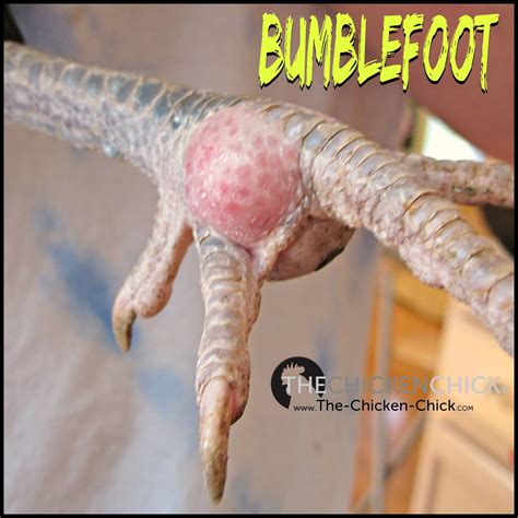 BUMBLEFOOT in Chickens: Causes & treatment. **WARNING: Graphic Photos** | The Chicken Chick®