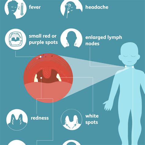 Strep Throat: Signs, Symptoms, and Complications