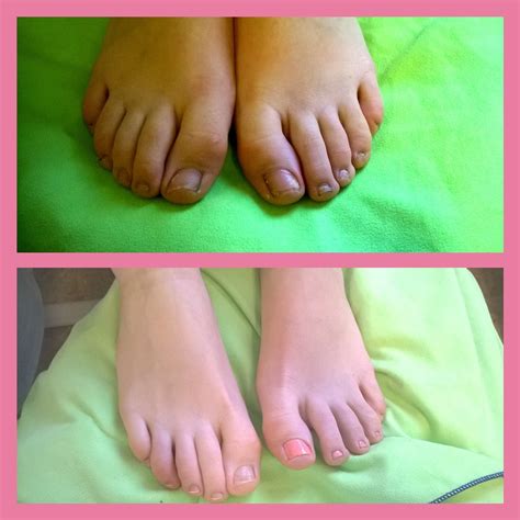 Pedicure: Before... and after (with and without nail polish) | Mobile ...