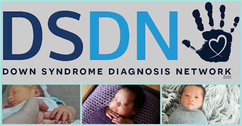 Down Syndrome Diagnosis Network