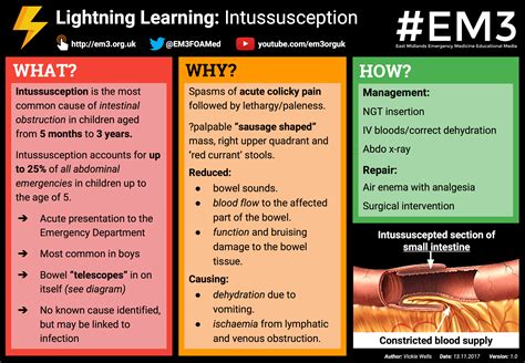 Lightning Learning: Intussusception — EM3