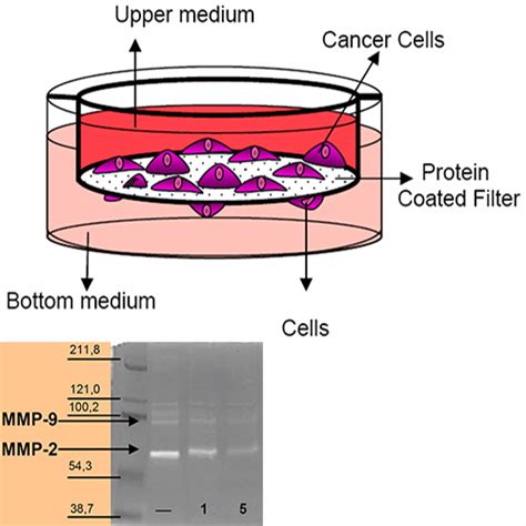 In vitro Cell Invasion Assay - Innoprot in vitro cell invasion assay