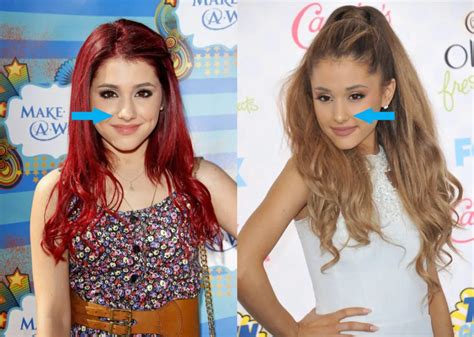 Ariana Grande Before & After: The Power of Plastic Surgery! - Demotix.com