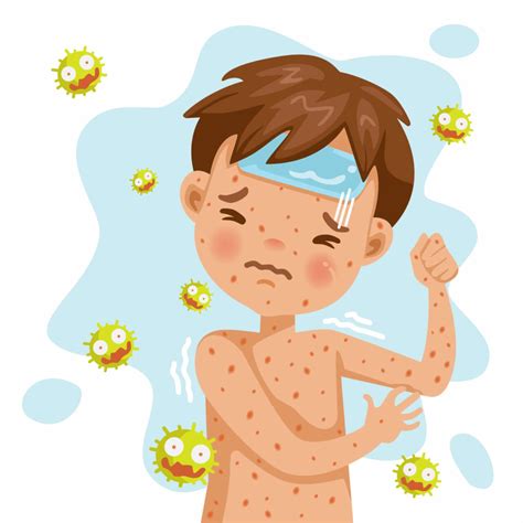 Signs and Symptoms of Chickenpox | What You Need to Know