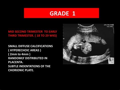 Placental grading