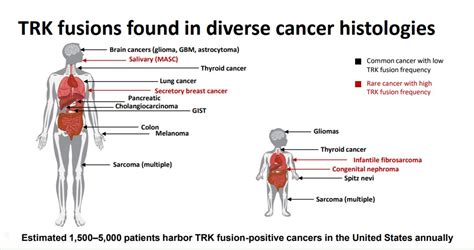 Loxo Oncology Presents Compelling Data on Its TRK Inhibitors - Valuentum Securities Inc.