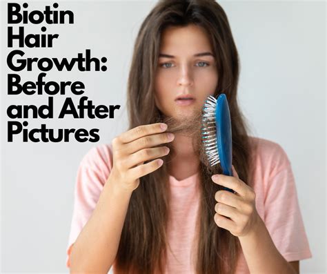 Biotin Hair Growth: Before and After Pictures – Yum Yum Mama