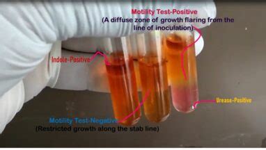 Motility Test: Introduction, Principle, Composition, Procedure, Result