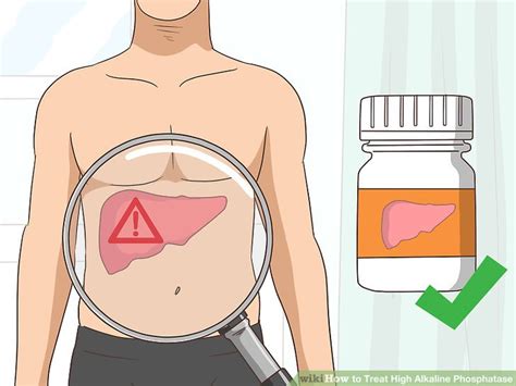 3 Ways to Treat High Alkaline Phosphatase - wikiHow