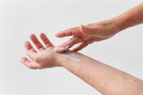 Adhesive Allergy: The 411 You Must Know