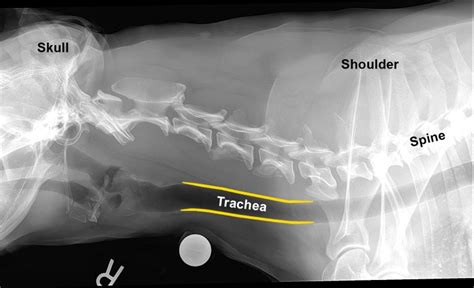 Tracheal Collapse: Medical Management Versus Implantable Stents