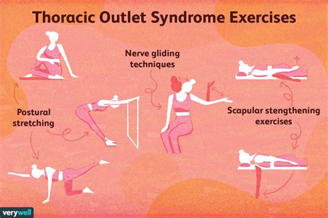 Thoracic Outlet Syndrome Exercises Stretches