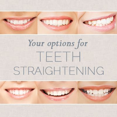 Teeth Straightening in Spring | Spring Creek Dentistry