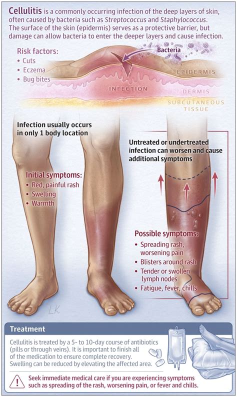 This Patient Page describes the symptoms, possible causes, and ...