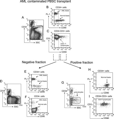 Positive selection for CD90 as a purging option in acute myeloid leukemia stem cell transplants ...