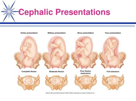 PPT - Normal Labor and Delivery Physiological Adaptations Chapter 17 PowerPoint Presentation ...