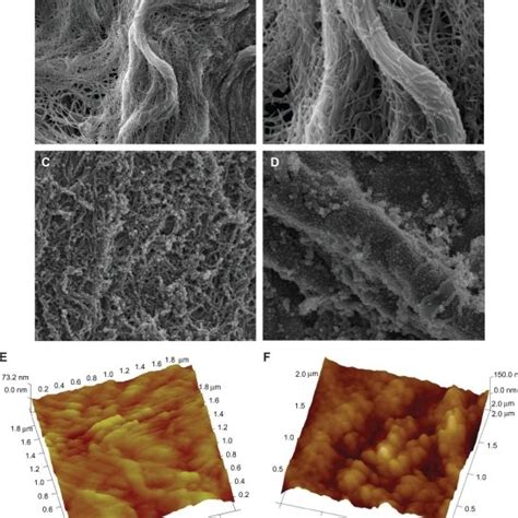 Herovici staining of collagen fibrils. Staining showed extracellular... | Download Scientific ...