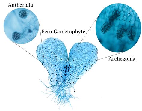 ‎Fern gametophyte with archegonia and antheridia - UWDC - UW-Madison ...