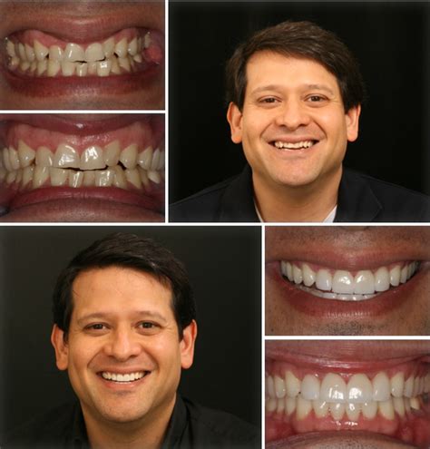 Cosmetic Dentistry Houston - Dental News Network