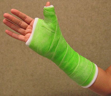 Broken Thumb Injuries Symptoms and Treatment | Orthoped