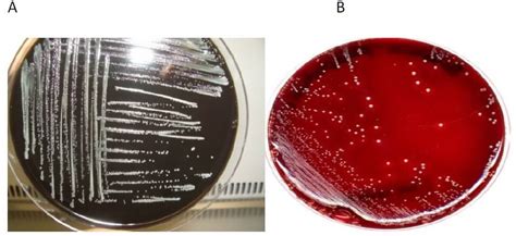 Bordetella pertussis- An Overview - Microbe Notes