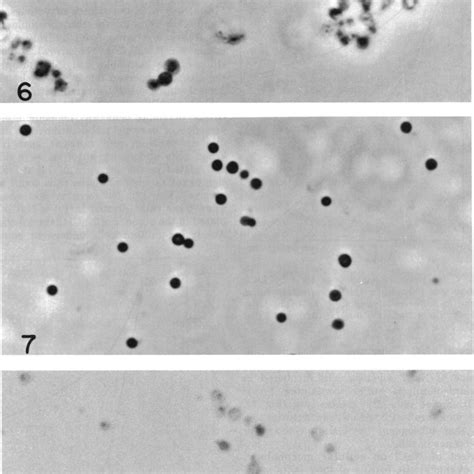 [PDF] Autolysis of Microbial Cells: Salt Activation of Autolytic Enzymes in a Mutant of ...