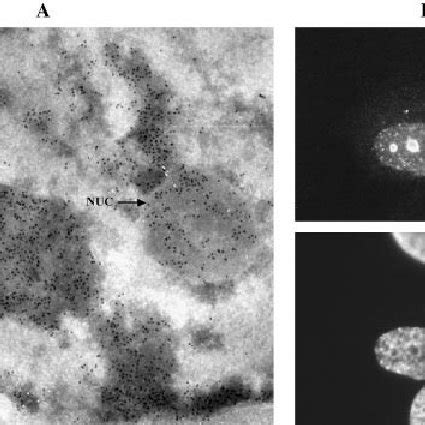 Apoptin, expressed in human tumour cells, localises to heterochromatin... | Download Scientific ...