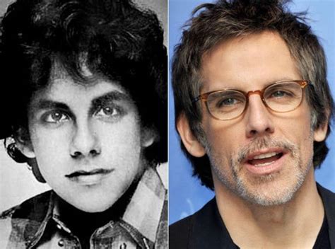 Ben Stiller before and after plastic surgery (32) – Celebrity plastic ...