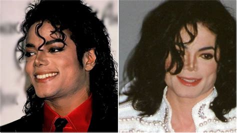 Did Michael Jackson Bleach His Skin? Star’s Skin Condition Explored