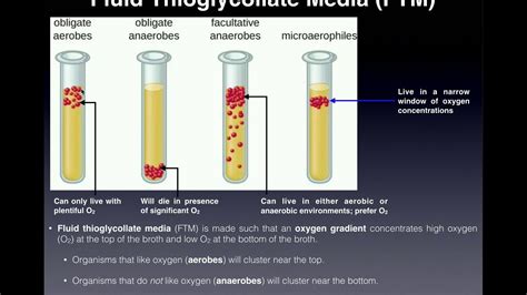 Basics of Fluid Thioglycollate Media (FTM) | With Examples - YouTube