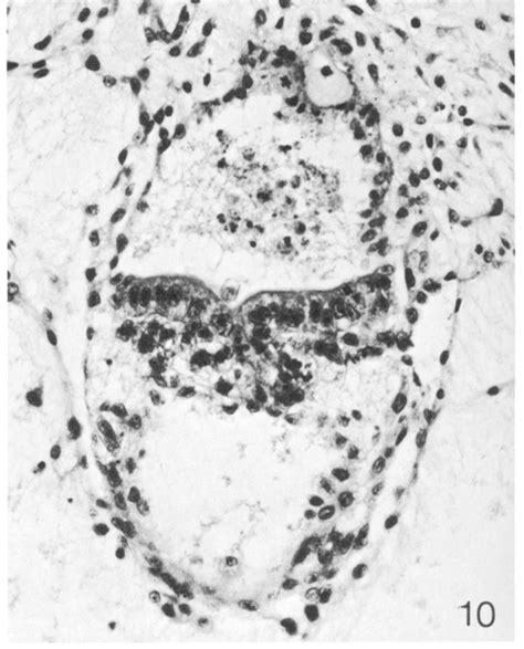 Carnegie Stage 6-6 – Embryonic disc